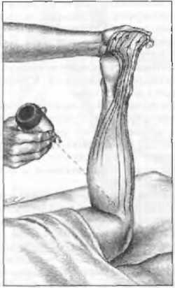 Миофасциальные боли и дисфункции. Руководство по триггерным точкам (в 2-х томах). Том 2. Нижние конечности - _11.jpg_8