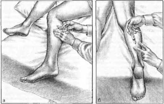 Миофасциальные боли и дисфункции. Руководство по триггерным точкам (в 2-х томах). Том 2. Нижние конечности - _12.jpg_7