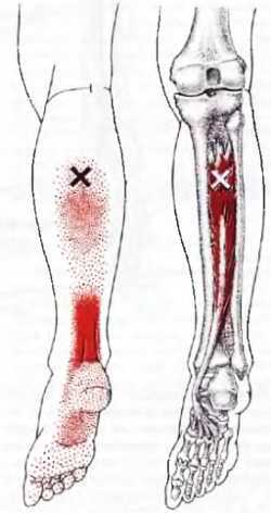 Миофасциальные боли и дисфункции. Руководство по триггерным точкам (в 2-х томах). Том 2. Нижние конечности - _14.jpg_3