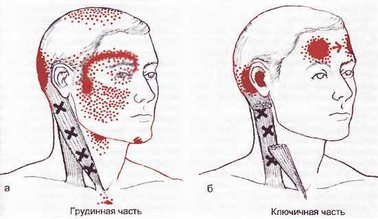 Миофасциальные боли и дисфункции. Руководство по триггерным точкам (в 2-х томах). Том 1. Верхняя половина туловища - _00.jpg_12