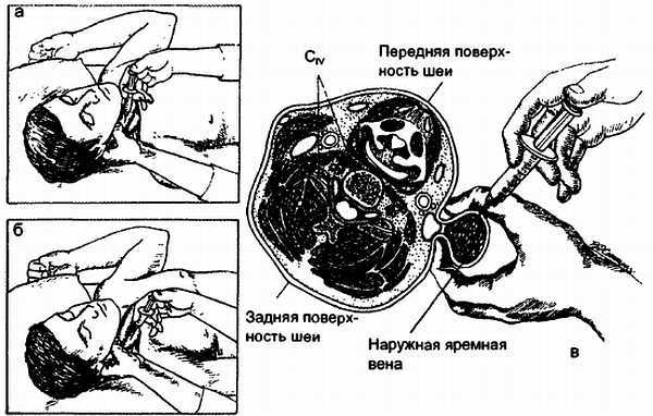 Миофасциальные боли и дисфункции. Руководство по триггерным точкам (в 2-х томах). Том 1. Верхняя половина туловища - _00.jpg_14