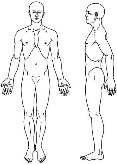Миофасциальные боли и дисфункции. Руководство по триггерным точкам (в 2-х томах). Том 1. Верхняя половина туловища - _00.jpg_4