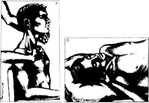 Миофасциальные боли и дисфункции. Руководство по триггерным точкам (в 2-х томах). Том 1. Верхняя половина туловища - _01.jpg_11