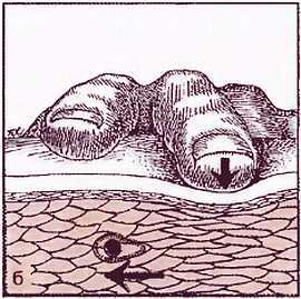 Миофасциальные боли и дисфункции. Руководство по триггерным точкам (в 2-х томах). Том 1. Верхняя половина туловища - _01.jpg_4