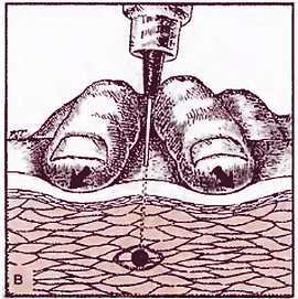Миофасциальные боли и дисфункции. Руководство по триггерным точкам (в 2-х томах). Том 1. Верхняя половина туловища - _02.jpg_4