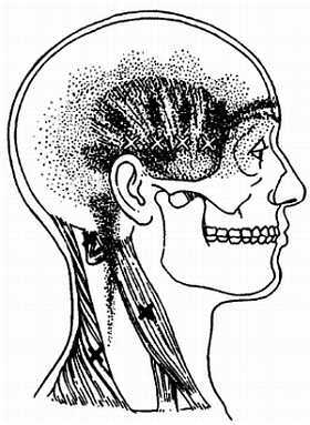 Миофасциальные боли и дисфункции. Руководство по триггерным точкам (в 2-х томах). Том 1. Верхняя половина туловища - _03.jpg_2