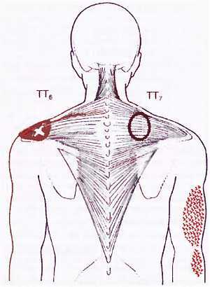 Миофасциальные боли и дисфункции. Руководство по триггерным точкам (в 2-х томах). Том 1. Верхняя половина туловища - _03.jpg_6