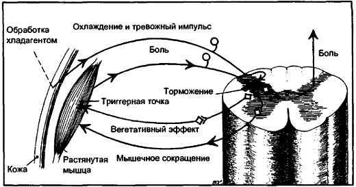 Миофасциальные боли и дисфункции. Руководство по триггерным точкам (в 2-х томах). Том 1. Верхняя половина туловища - _13.jpg_1