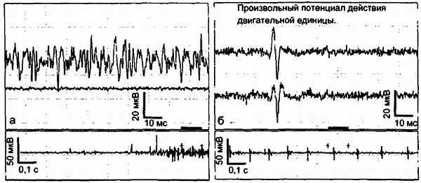 Миофасциальные боли и дисфункции. Руководство по триггерным точкам (в 2-х томах). Том 1. Верхняя половина туловища - _14.jpg