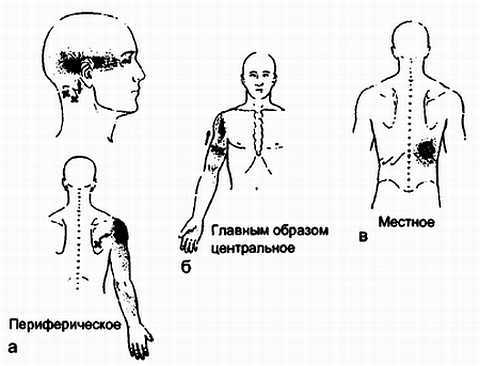 Миофасциальные боли и дисфункции. Руководство по триггерным точкам (в 2-х томах). Том 1. Верхняя половина туловища - _16.jpg_0