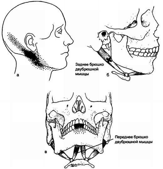 Миофасциальные боли и дисфункции. Руководство по триггерным точкам (в 2-х томах). Том 1. Верхняя половина туловища - _00.jpg_19