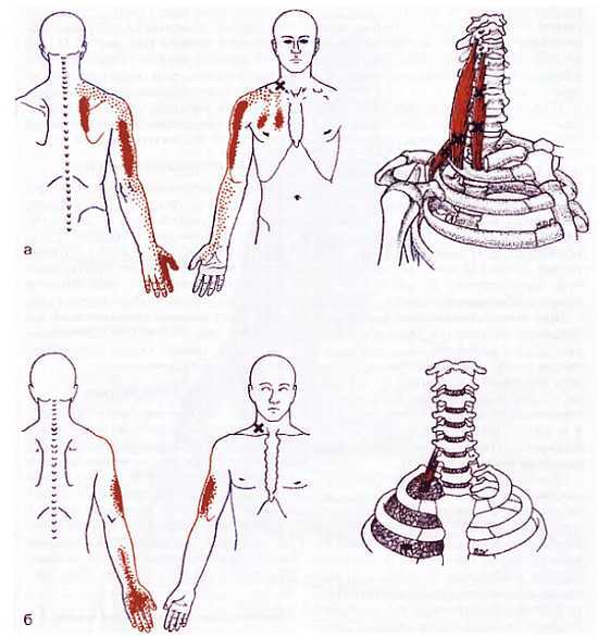 Миофасциальные боли и дисфункции. Руководство по триггерным точкам (в 2-х томах). Том 1. Верхняя половина туловища - _00.jpg_29