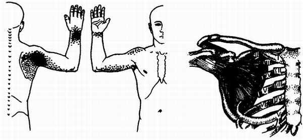 Миофасциальные боли и дисфункции. Руководство по триггерным точкам (в 2-х томах). Том 1. Верхняя половина туловища - _00.jpg_35