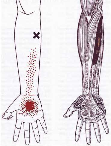 Миофасциальные боли и дисфункции. Руководство по триггерным точкам (в 2-х томах). Том 1. Верхняя половина туловища - _00.jpg_42