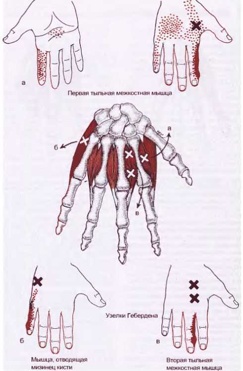 Миофасциальные боли и дисфункции. Руководство по триггерным точкам (в 2-х томах). Том 1. Верхняя половина туловища - _00.jpg_44