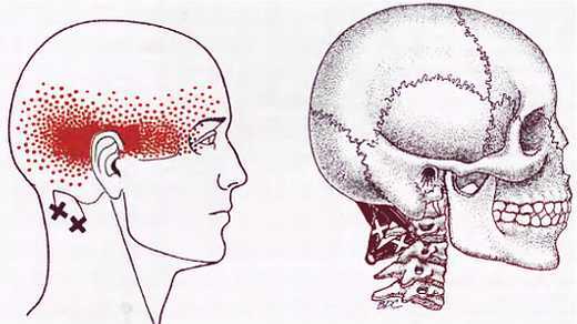 Миофасциальные боли и дисфункции. Руководство по триггерным точкам (в 2-х томах). Том 1. Верхняя половина туловища - _01.jpg_22