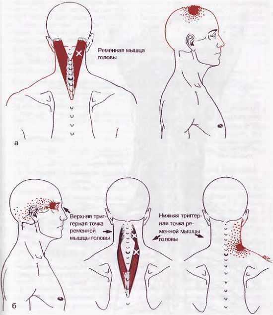 Миофасциальные боли и дисфункции. Руководство по триггерным точкам (в 2-х томах). Том 1. Верхняя половина туловища - _02.jpg_19