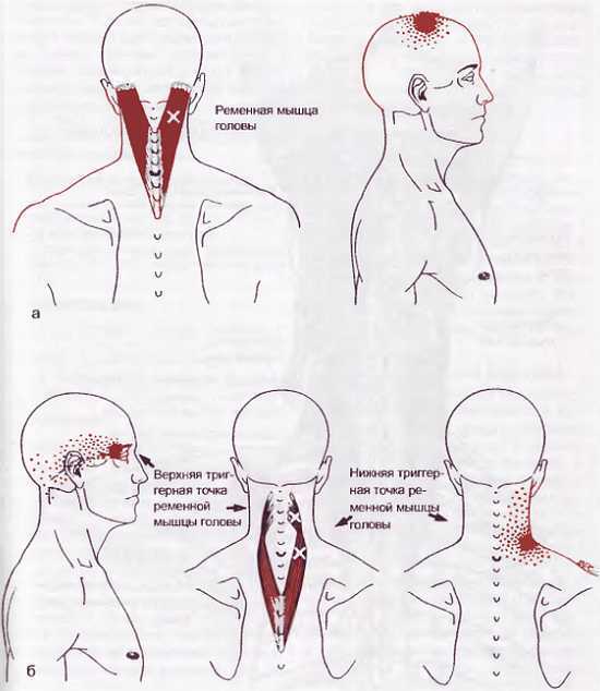 Миофасциальные боли и дисфункции. Руководство по триггерным точкам (в 2-х томах). Том 1. Верхняя половина туловища - _02.jpg_19
