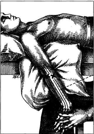 Миофасциальные боли и дисфункции. Руководство по триггерным точкам (в 2-х томах). Том 1. Верхняя половина туловища - _02.jpg_33