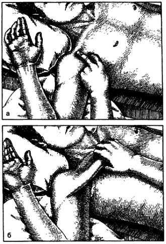 Миофасциальные боли и дисфункции. Руководство по триггерным точкам (в 2-х томах). Том 1. Верхняя половина туловища - _02.jpg_41