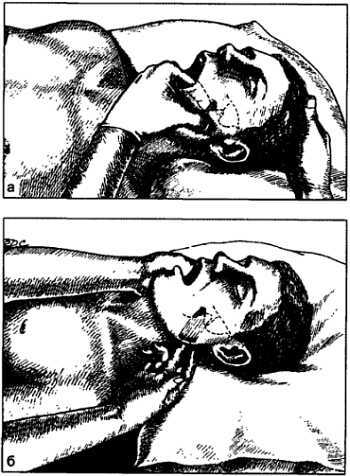 Миофасциальные боли и дисфункции. Руководство по триггерным точкам (в 2-х томах). Том 1. Верхняя половина туловища - _03.jpg_10