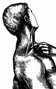 Миофасциальные боли и дисфункции. Руководство по триггерным точкам (в 2-х томах). Том 1. Верхняя половина туловища - _03.jpg_14