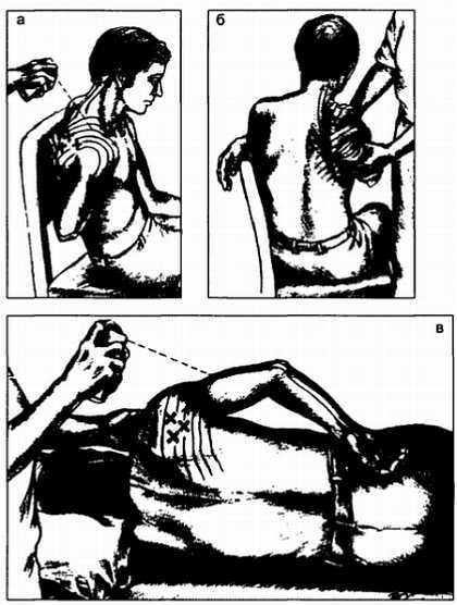 Миофасциальные боли и дисфункции. Руководство по триггерным точкам (в 2-х томах). Том 1. Верхняя половина туловища - _03.jpg_21