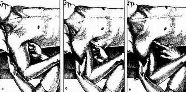 Миофасциальные боли и дисфункции. Руководство по триггерным точкам (в 2-х томах). Том 1. Верхняя половина туловища - _03.jpg_25