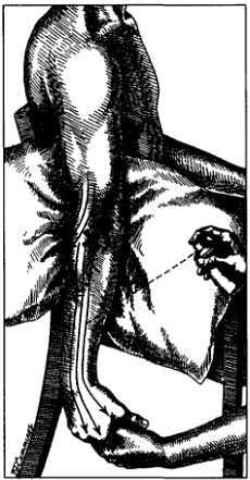 Миофасциальные боли и дисфункции. Руководство по триггерным точкам (в 2-х томах). Том 1. Верхняя половина туловища - _03.jpg_29