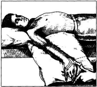 Миофасциальные боли и дисфункции. Руководство по триггерным точкам (в 2-х томах). Том 1. Верхняя половина туловища - _03.jpg_33