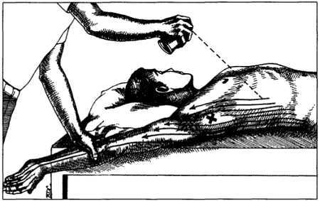 Миофасциальные боли и дисфункции. Руководство по триггерным точкам (в 2-х томах). Том 1. Верхняя половина туловища - _04.jpg_21
