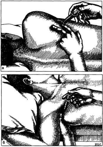 Миофасциальные боли и дисфункции. Руководство по триггерным точкам (в 2-х томах). Том 1. Верхняя половина туловища - _04.jpg_22