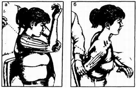 Миофасциальные боли и дисфункции. Руководство по триггерным точкам (в 2-х томах). Том 1. Верхняя половина туловища - _04.jpg_24