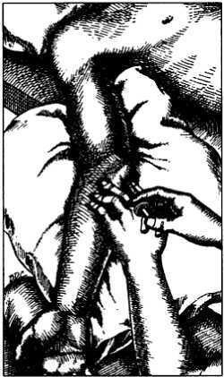 Миофасциальные боли и дисфункции. Руководство по триггерным точкам (в 2-х томах). Том 1. Верхняя половина туловища - _04.jpg_30