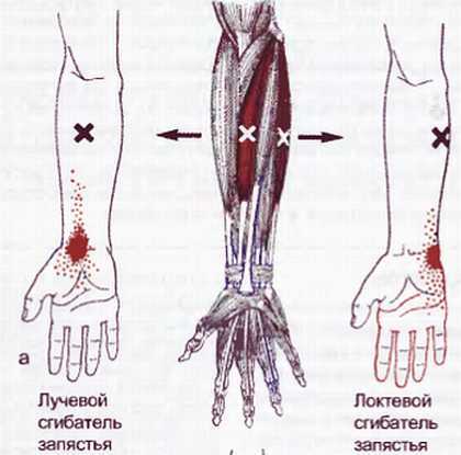 Миофасциальные боли и дисфункции. Руководство по триггерным точкам (в 2-х томах). Том 1. Верхняя половина туловища - _04.jpg_31