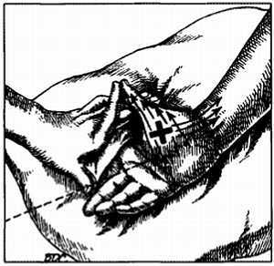 Миофасциальные боли и дисфункции. Руководство по триггерным точкам (в 2-х томах). Том 1. Верхняя половина туловища - _04.jpg_32