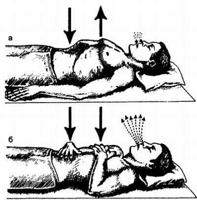 Миофасциальные боли и дисфункции. Руководство по триггерным точкам (в 2-х томах). Том 1. Верхняя половина туловища - _05.jpg_17