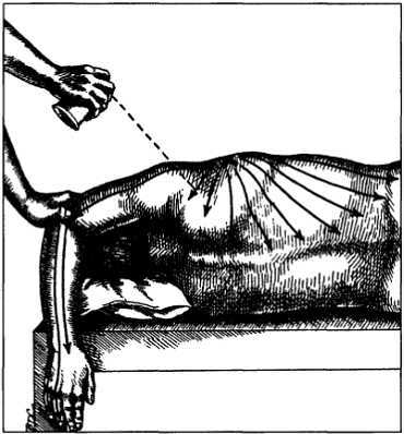 Миофасциальные боли и дисфункции. Руководство по триггерным точкам (в 2-х томах). Том 1. Верхняя половина туловища - _05.jpg_19