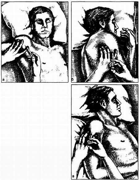 Миофасциальные боли и дисфункции. Руководство по триггерным точкам (в 2-х томах). Том 1. Верхняя половина туловища - _05.jpg_21