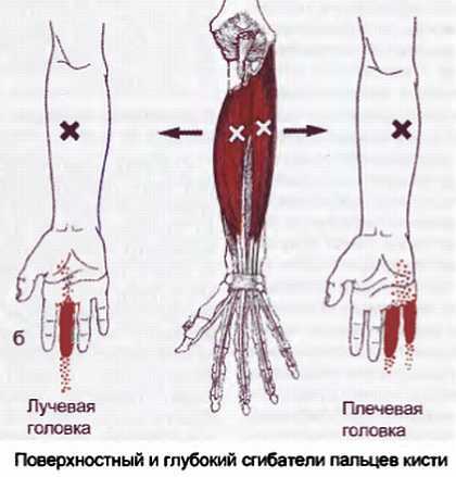 Миофасциальные боли и дисфункции. Руководство по триггерным точкам (в 2-х томах). Том 1. Верхняя половина туловища - _05.jpg_26