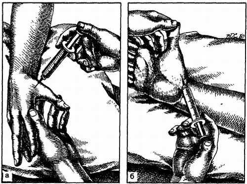Миофасциальные боли и дисфункции. Руководство по триггерным точкам (в 2-х томах). Том 1. Верхняя половина туловища - _05.jpg_27