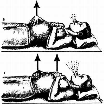Миофасциальные боли и дисфункции. Руководство по триггерным точкам (в 2-х томах). Том 1. Верхняя половина туловища - _06.jpg_15