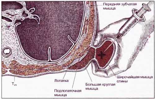 Миофасциальные боли и дисфункции. Руководство по триггерным точкам (в 2-х томах). Том 1. Верхняя половина туловища - _06.jpg_17