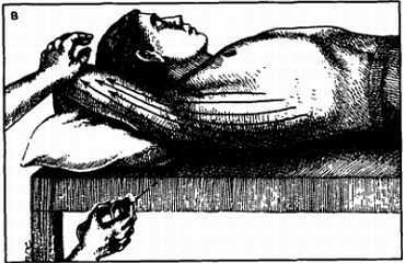 Миофасциальные боли и дисфункции. Руководство по триггерным точкам (в 2-х томах). Том 1. Верхняя половина туловища - _06.jpg_18