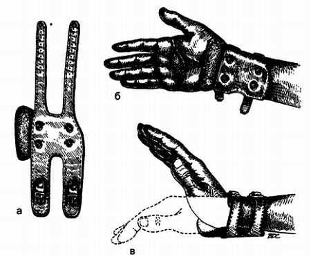 Миофасциальные боли и дисфункции. Руководство по триггерным точкам (в 2-х томах). Том 1. Верхняя половина туловища - _06.jpg_23