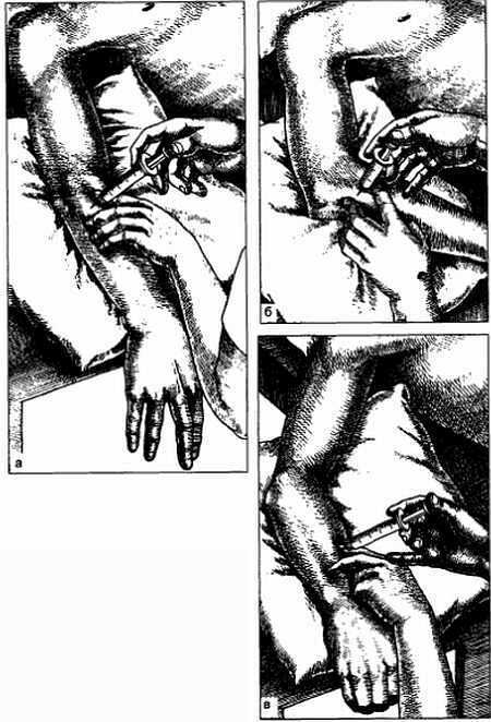 Миофасциальные боли и дисфункции. Руководство по триггерным точкам (в 2-х томах). Том 1. Верхняя половина туловища - _06.jpg_24