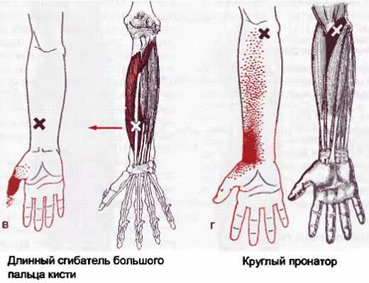 Миофасциальные боли и дисфункции. Руководство по триггерным точкам (в 2-х томах). Том 1. Верхняя половина туловища - _06.jpg_25