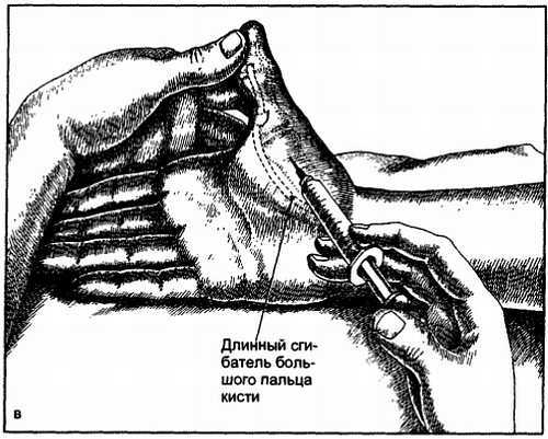 Миофасциальные боли и дисфункции. Руководство по триггерным точкам (в 2-х томах). Том 1. Верхняя половина туловища - _06.jpg_26