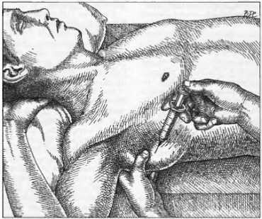 Миофасциальные боли и дисфункции. Руководство по триггерным точкам (в 2-х томах). Том 1. Верхняя половина туловища - _07.jpg_12