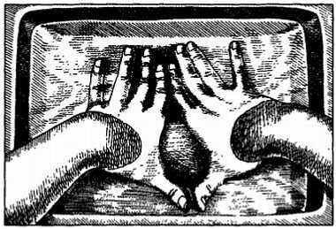 Миофасциальные боли и дисфункции. Руководство по триггерным точкам (в 2-х томах). Том 1. Верхняя половина туловища - _07.jpg_19